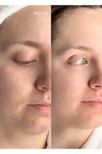 Summer Skin Care Hacks