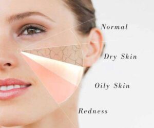 Best Facewash Tips for Oily Skin in India