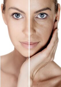 Benefits of using mulberry extract in summer skincare