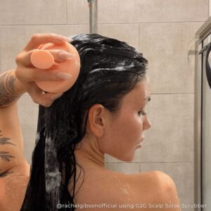 What causes dandruff