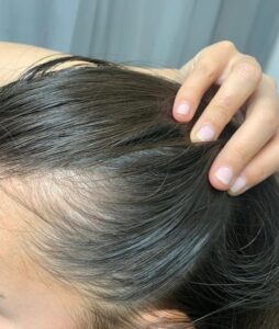Rosemary Oil Uses for Hair