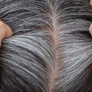 Rosemary Oil Uses for Hair