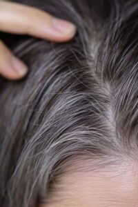 Rosemary Oil Uses for Hair