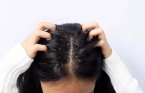 Rosemary Oil Uses for Hair