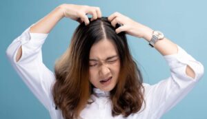 What causes dandruff