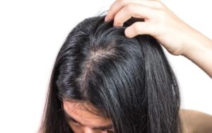 Oily Scalp Solutions
