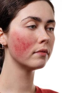 Mosquito Repellent Tips