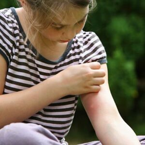 Mosquito Repellent Tips