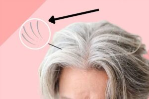 Premature grey hair treatment naturally