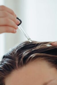 Greasy scalp and flakes