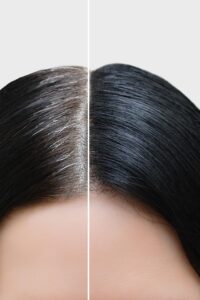 Monsoon Hair Breakage