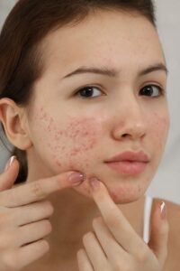 Basic Skincare Routine