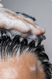 Post-Diwali Scalp Detox